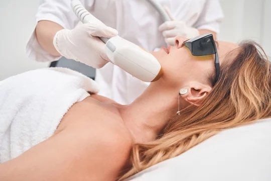 Photo Facial IPL ,Microneedling with hyaluron 6-Month service